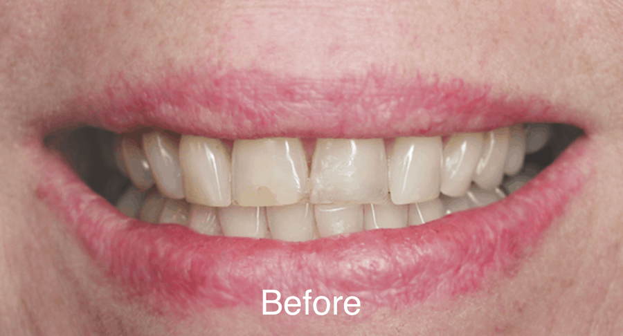 Smile Gallery Before & After - Joseph Majka, DDS