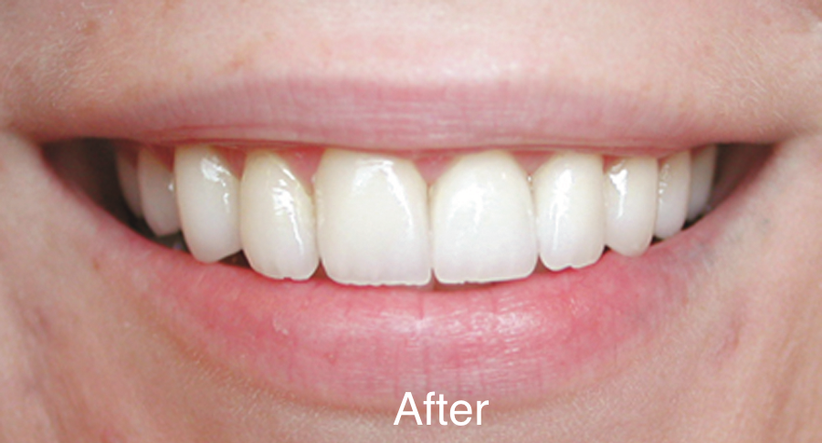 Smile Gallery Before & After - Joseph Majka, DDS