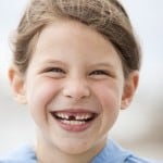 child with missing front tooth