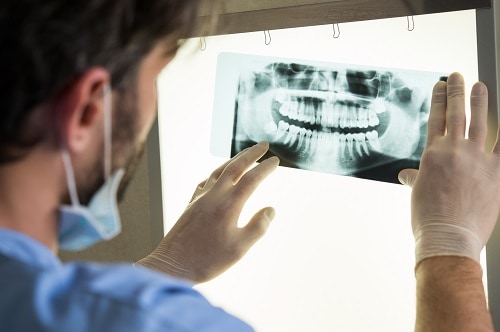 male dentist examines dental x-ray